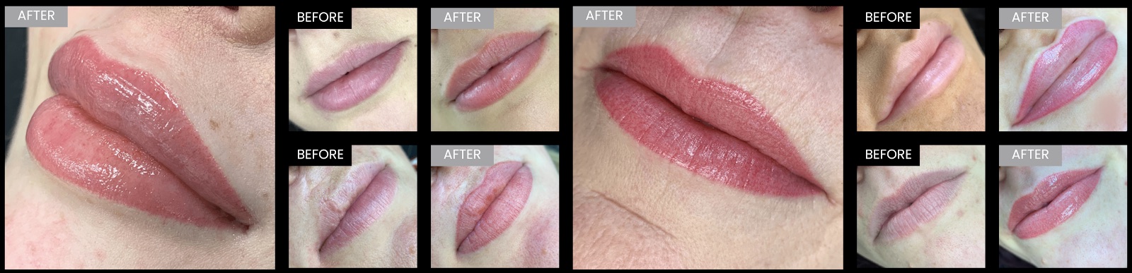 Lip blush before and after results
